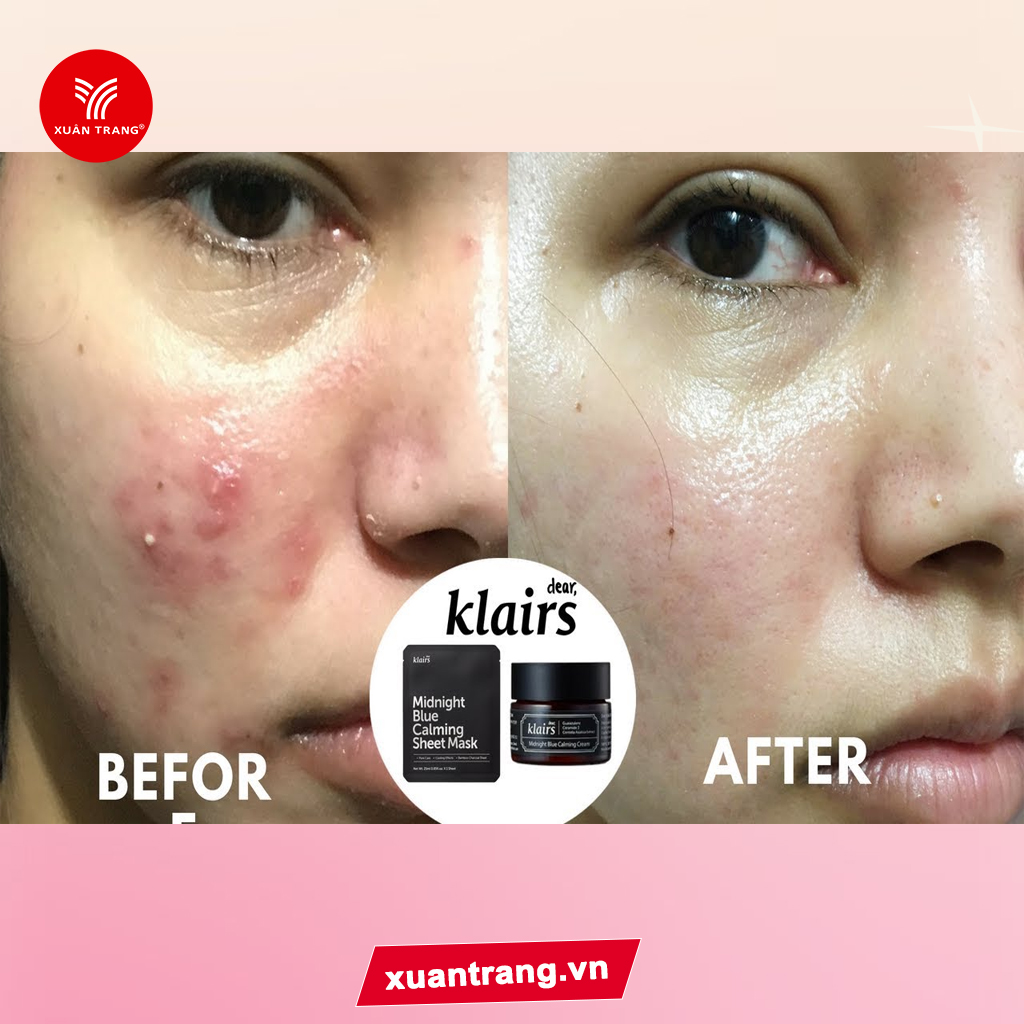 KLAIRS_Kem Midnight Blue Calming Cream 30Ml (725610)