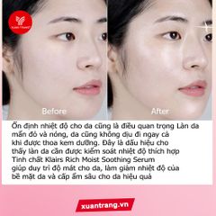 KLAIRS_Tinh Chất Rich Moist Soothing Serum 80Ml (2188197)