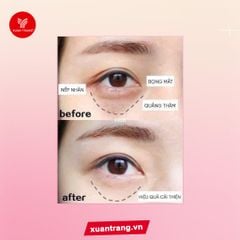O HUI_Kem Mắt Age Recovery Eye Cream 25ml