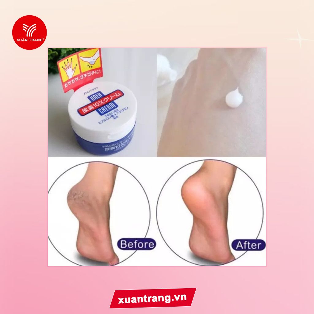 Shiseido_Kem Trị Nứt Gót Tay Chân Urea Cream 100g