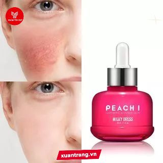 Milky Dress_Serum Huyết Thanh Cô Đặc 30Ml