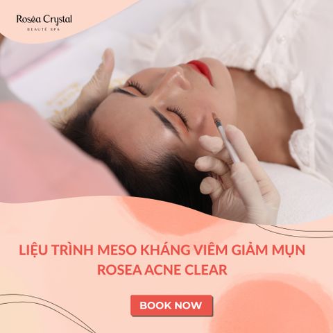  Liệu trình Meso kháng viêm, giảm mụn Rosea Acne Clear 