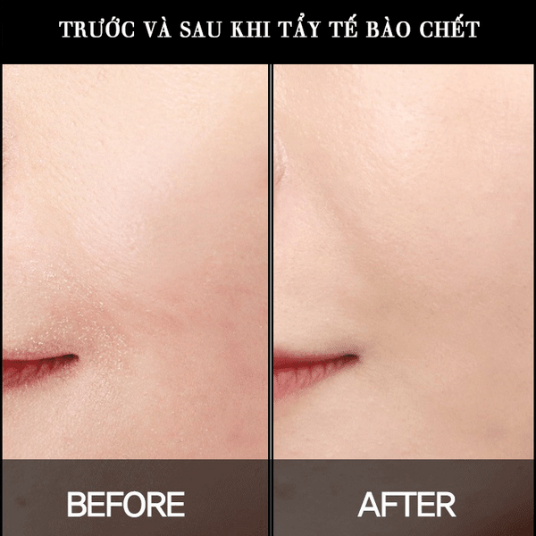  Dung dịch loại bỏ tế bào chết Paula's Choice Skin Perfecting 2% BHA Liquid Exfoliant - CHÍNH HÃNG 