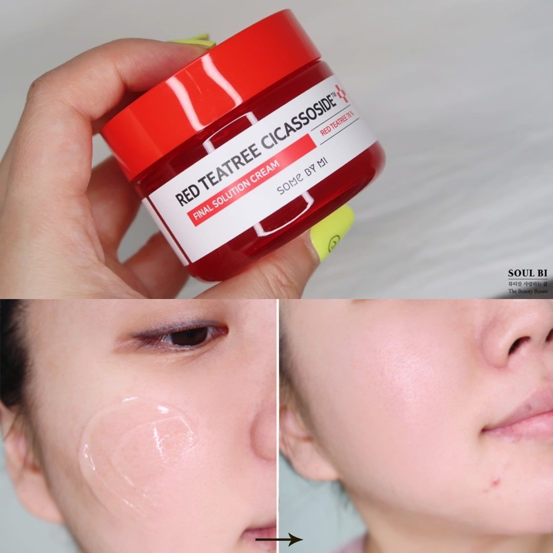  Kem Dưỡng Giảm Mụn Some By Mi Red Teatree Cicassoside Final Solution Cream 