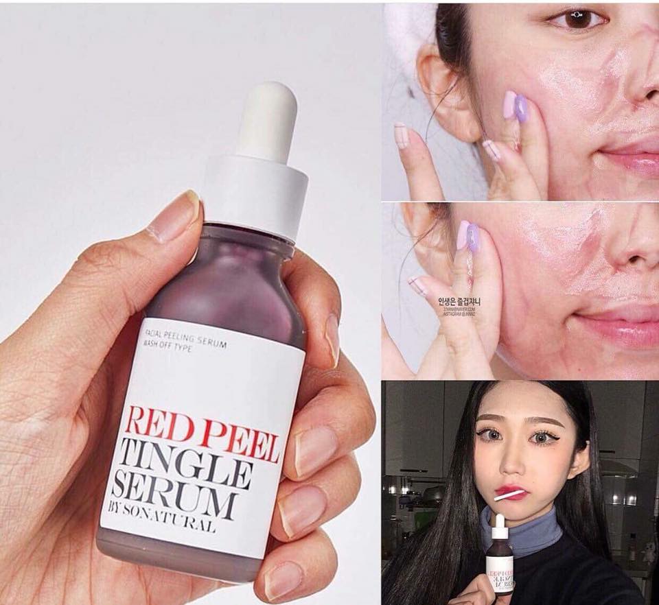 SoNatural Red Peel Tingle Serum-bicicosmetics.vn