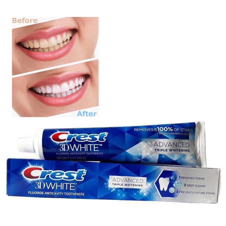  Kem Đành Răng Trắng Răng, Loại Bỏ 100% Mảng Bám CREST 3D White Advanced Whitening 147gr 