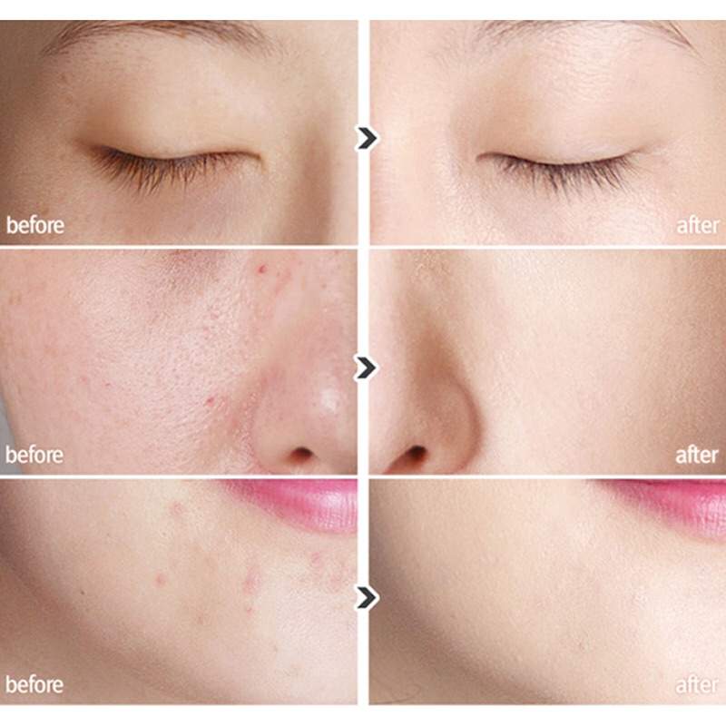 Kem Che Khuyết Điểm All Day Tip Concealer #01 Light Beige lâu trôi và có độ che phủ cao