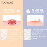  Miếng Dán Mụn Sưng Đỏ, Đẩy Cồi Mụn FOCALLURE Acne Pimple Patch 24P | FA-186 