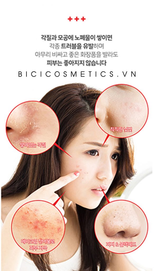 Thử ngay phương pháp đánh bay mụn đầu đen chai lì được các beauty blogger áp dụng mỗi ngày– bicicosmetics.vn
