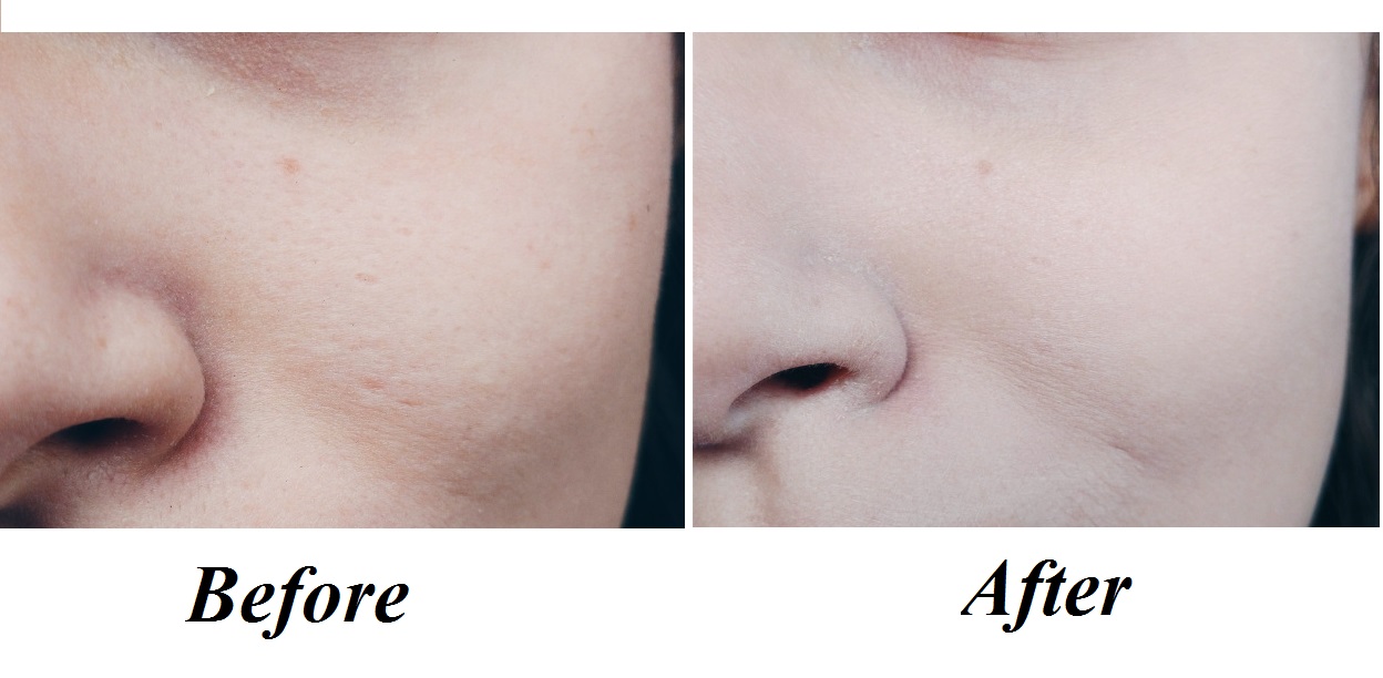 Thử và trải nghiệm ngay những công dụng tuyệt vời của Kem lót NYX Pore Filler POF01