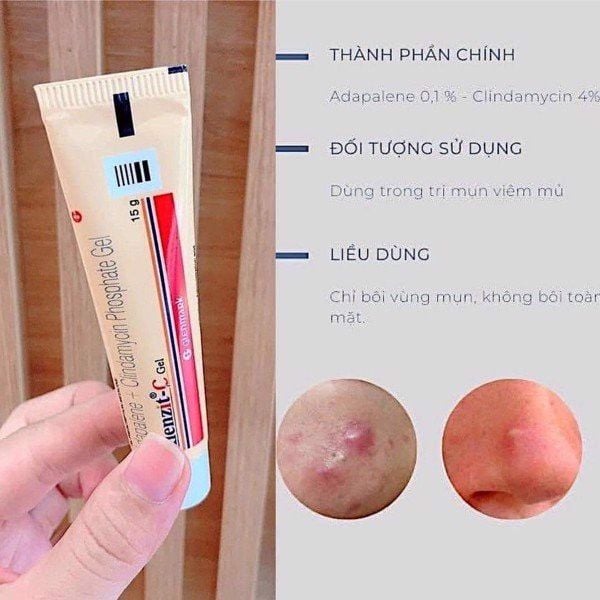  Gel chấm trị mụn viêm, mụn ẩn Klenzit-C 15g 