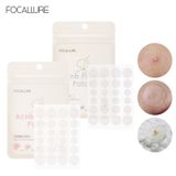  Miếng Dán Mụn Sưng Đỏ, Đẩy Cồi Mụn FOCALLURE Acne Pimple Patch 24P | FA-186 