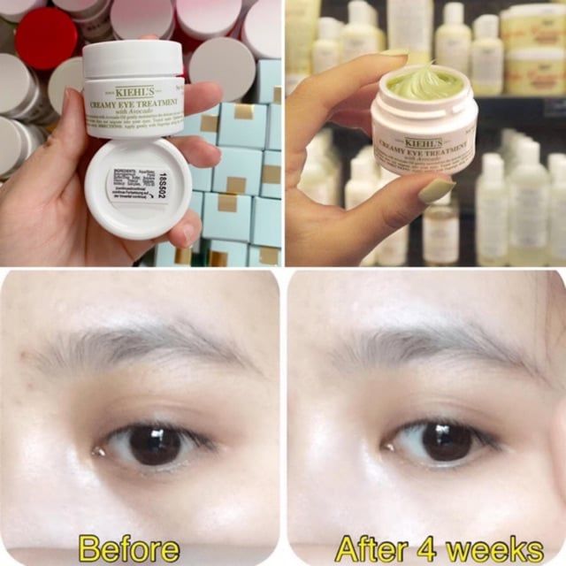  Kem Dưỡng Mắt Chiết Xuất Bơ Dưỡng Ẩm Giảm Sưng Bọng Mắt Kiehl's Avocado Creamy Eye Treatment 