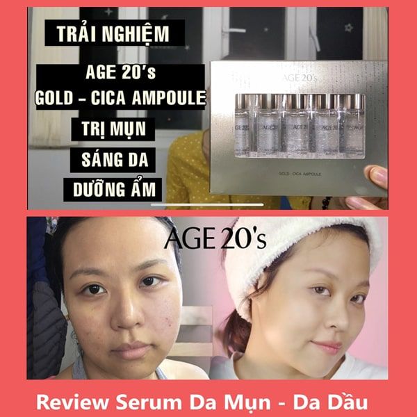  Set Tinh Chất Age 20's Gold - Cica Ampoule 