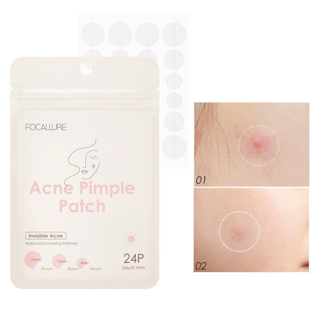  Miếng Dán Mụn Sưng Đỏ, Đẩy Cồi Mụn FOCALLURE Acne Pimple Patch 24P | FA-186 