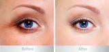  Tinh Chất Chống Nhăn Trẻ Hóa Vùng Mắt BALANCE Active Formula Gold + Marine Collagen Rejuvenating Eye serum - 15ml 