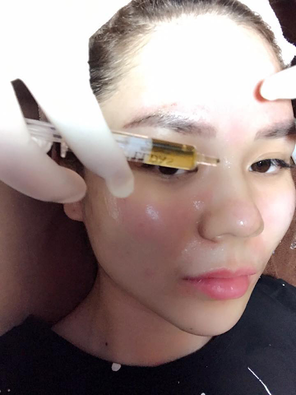 Trực tiếp đưa Tế Bào Gốc Eldas lên da mặt Trực tiếp đưa Tế Bào Gốc Eldas lên da mặt