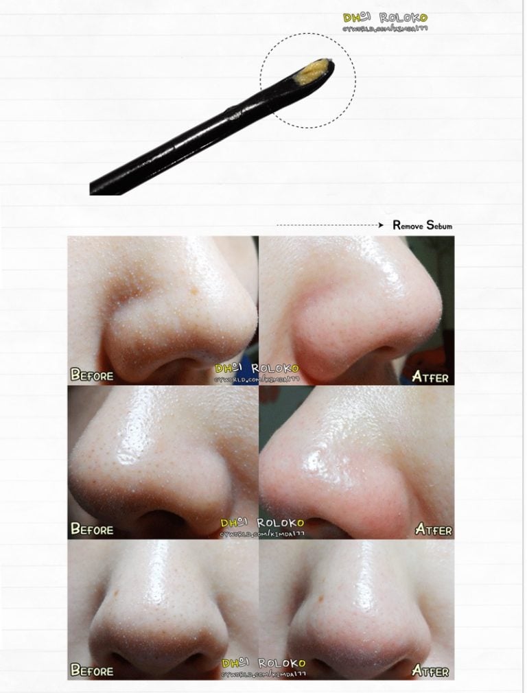 Thử ngay phương pháp đánh bay mụn đầu đen chai lì được các beauty blogger áp dụng mỗi ngày – bicicosmetics.vn