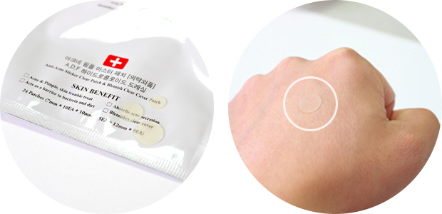 Miếng Dán Mụn Cosrx Acne Pimple Master Patch