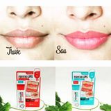  (Đủ bộ) Sản Phẩm Chăm Dưỡng Môi MEDIHEAL Labocare Panteno Lips 