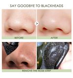 Miếng Dán Lột Mụn Đầu Đen Vùng Mũi FOCALLURE Blackhead Remover Pore Strips | FA-171 