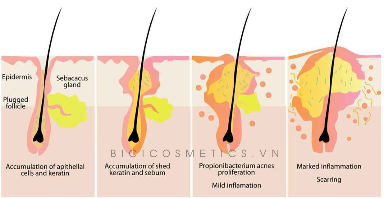 Miracle AHA- BHA- PHA3 - Bici Cosmetics