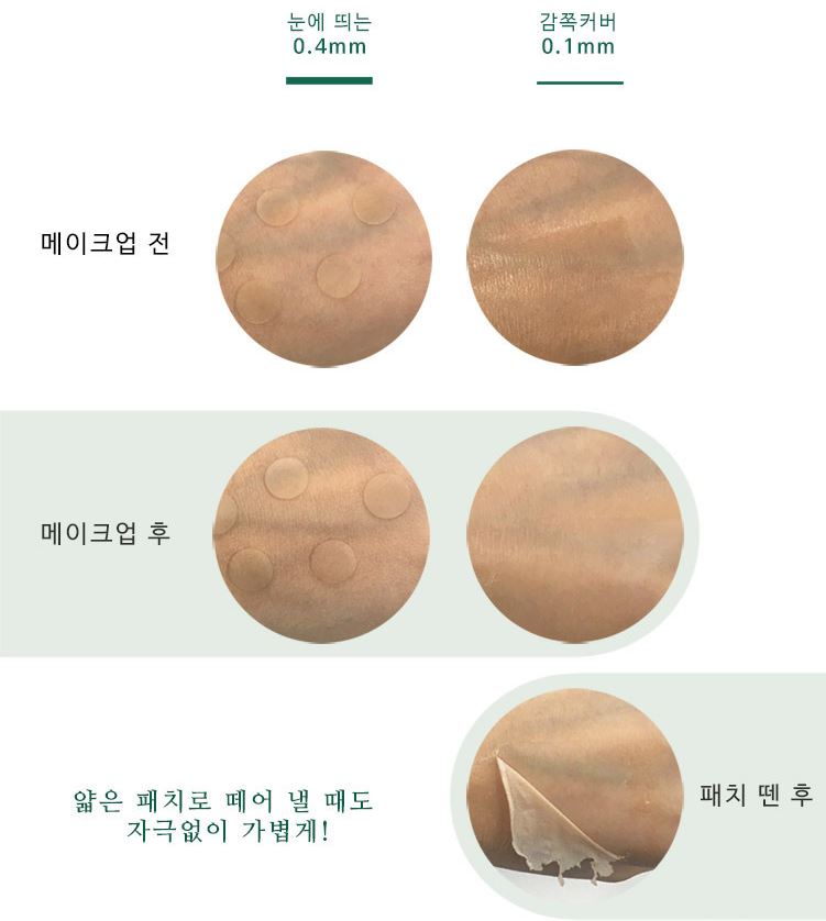 Gel Che Mụn L'arvore Derma Skin Patch giải quyết triệt để vấn đề che mụn 1