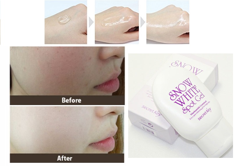 Gel trị thâm Snow White Spot Gel