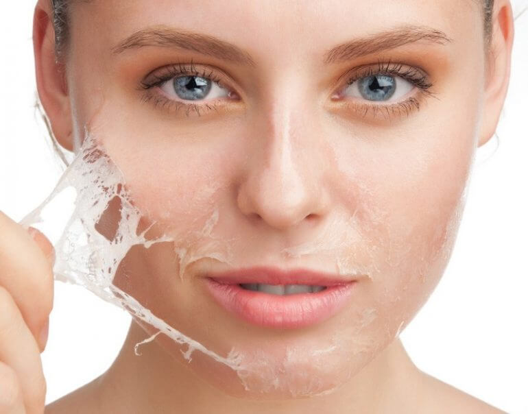 peel da mặt-peel da trị mụn-bicicosmetics.vn