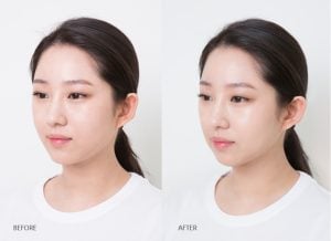 Trước và sau khi sử dụng Phấn phủ Innisfree No Sebum Moisture Powder 1