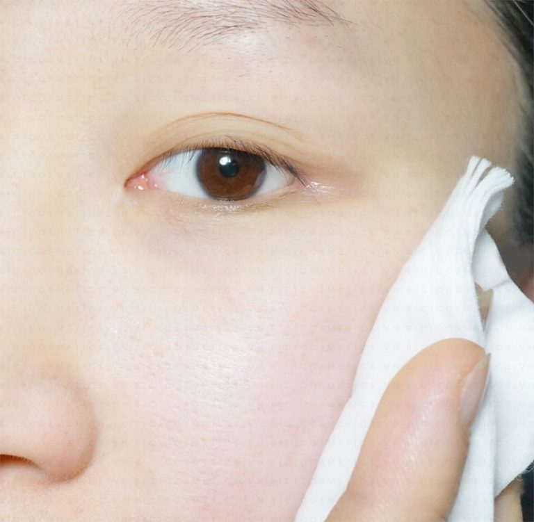 Thử ngay phương pháp đánh bay mụn đầu đen chai lì được các beauty blogger áp dụng mỗi ngày– bicicosmetics.vn