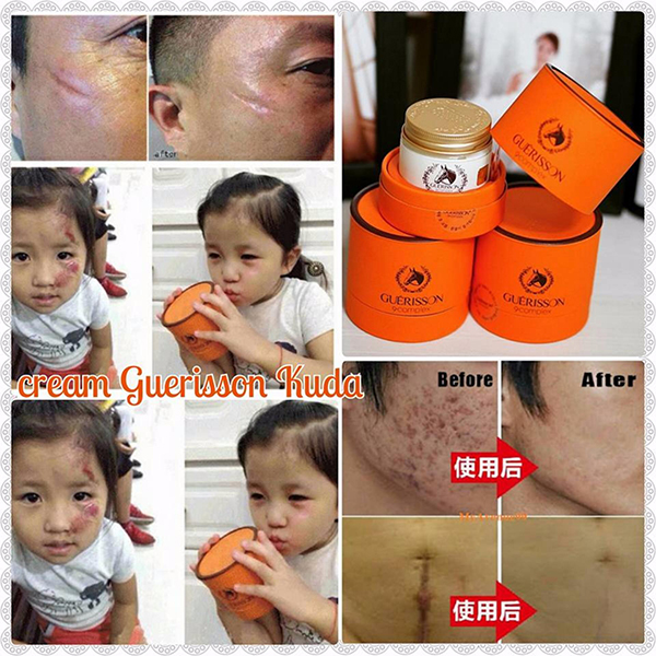 Kem Dầu Ngựa Guerisson 9 Complex- bicicosmetics.vn