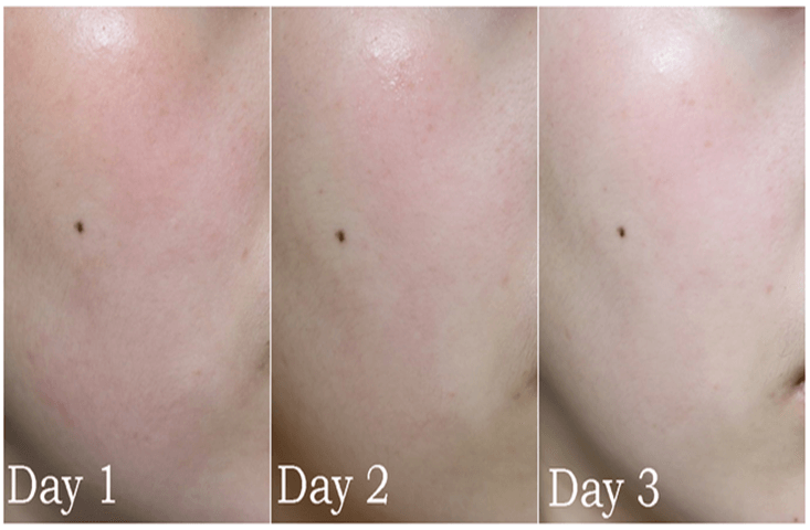công dụng Skin1004 Madagascar Centella Asiatica Cream
