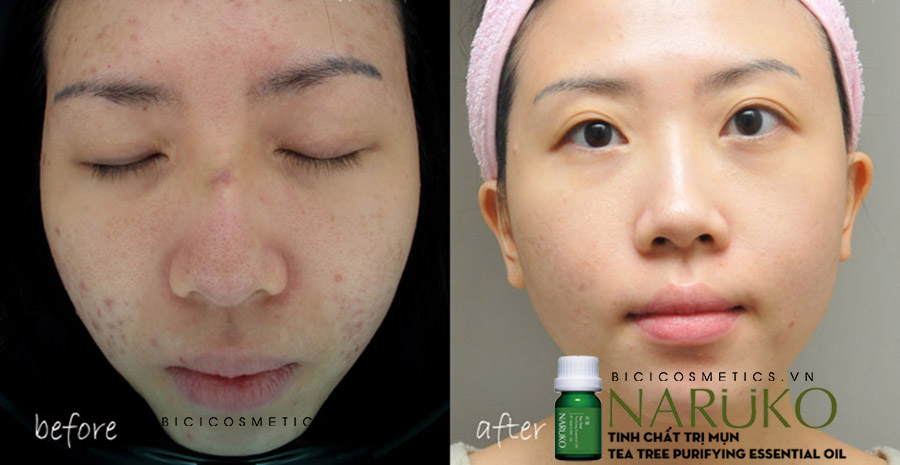 Sản phẩm không khuyến khích - bici cosmetics
