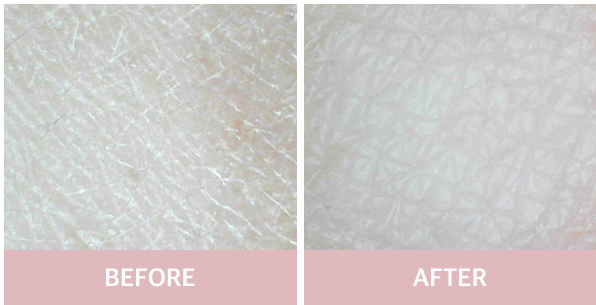 Mặt Nạ Đất Sét A'pieu Calamine Clay Pack 7- Bici Cosmetics
