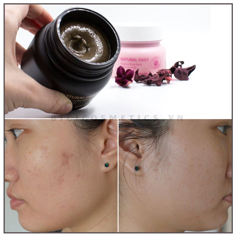 Trước và sau khi sử dụng The Saem Natural Daily Original Coffee Mask 1