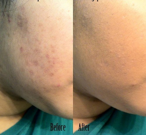 Phấn Tươi Essence Soft Touch Mousse Make-up có khả năng che phủ cao 1
