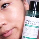  Nước Hoa Hồng Trị Mụn Some By Mi AHA-BHA-PHA 30 Days Miracle Toner 150ml 