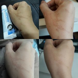 Công dụng kem trị sẹo nga Klirvin 2 Công dụng kem trị sẹo nga Klirvin 1