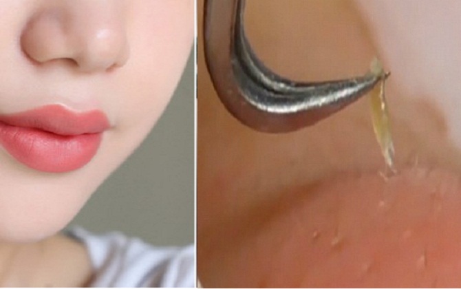 Vacosi Nhíp Gắp Mụn Thần Kỳ Blackhead Tweezers có chất liệu bằng inox không gỉ an toàn, vệ sinh 1