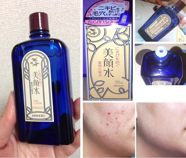 Bigansui Medicated Skin Lotion rất thích hợp cho da dầu mụn 1
