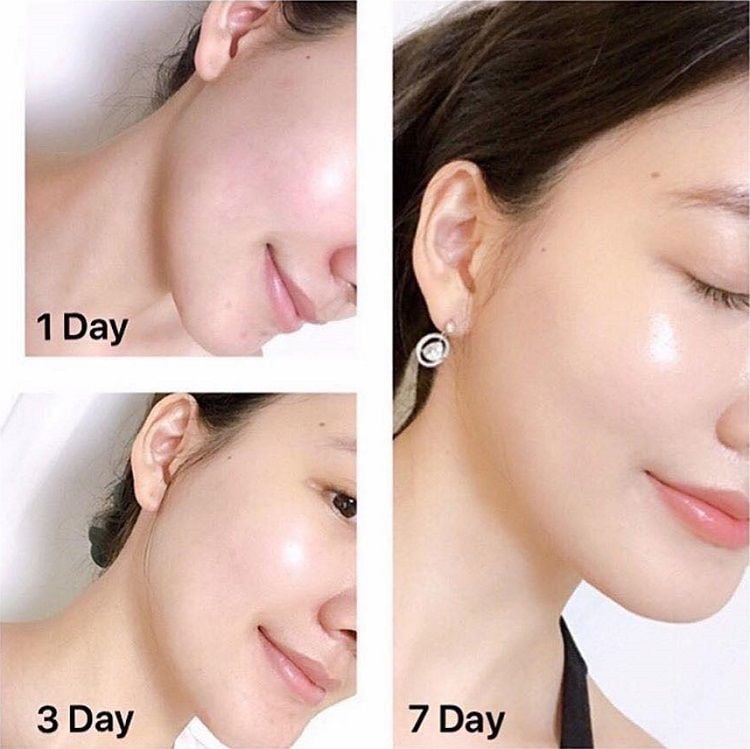  Kem Dưỡng Trắng Mờ Thâm Nám OLAY TOTAL EFFECTS Nourish Vitamin C & B3 - 50ml 