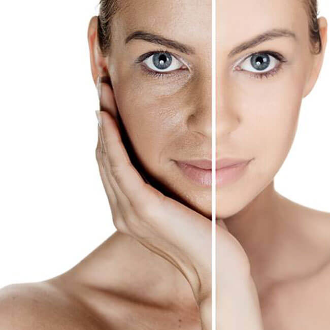 Kem Chống Lão Hoá Balance Active Formula Instant Effect Wrinkle Filler