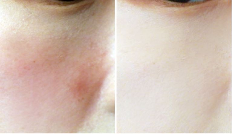 Phấn Nén Carenel 2- Bici Cosmetics