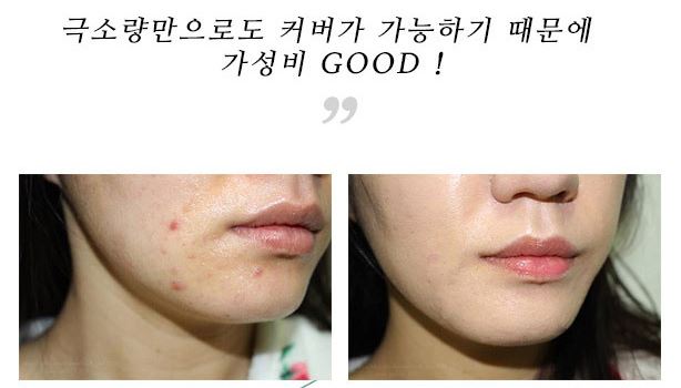 Gel Che Mụn L'arvore Derma Skin Patch hiệu quả ngay tức thì 1