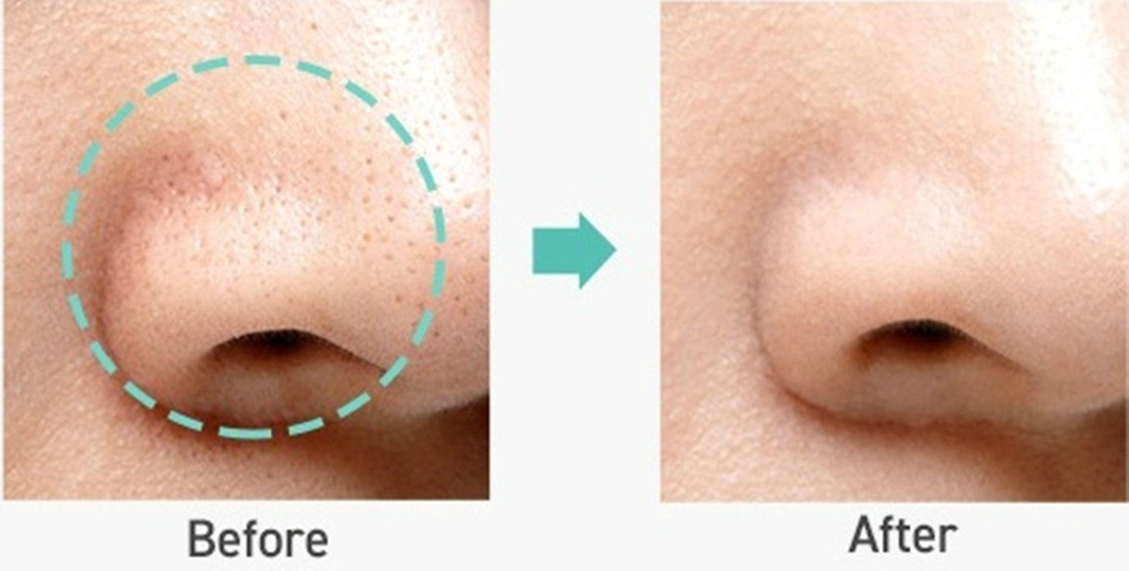 Hiệu quả che phủ lỗ chân lông rõ rệt chỉ sau 1 lớp lót