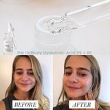  Serum Cấp Nước Và Phục Hồi Da THE ORDINARY Hyaluronic Acid 2% + B5 