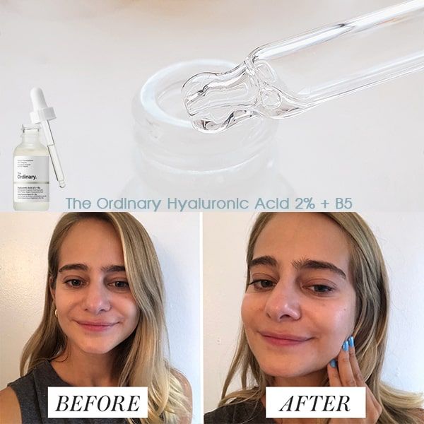  Serum Cấp Nước Và Phục Hồi Da THE ORDINARY Hyaluronic Acid 2% + B5 