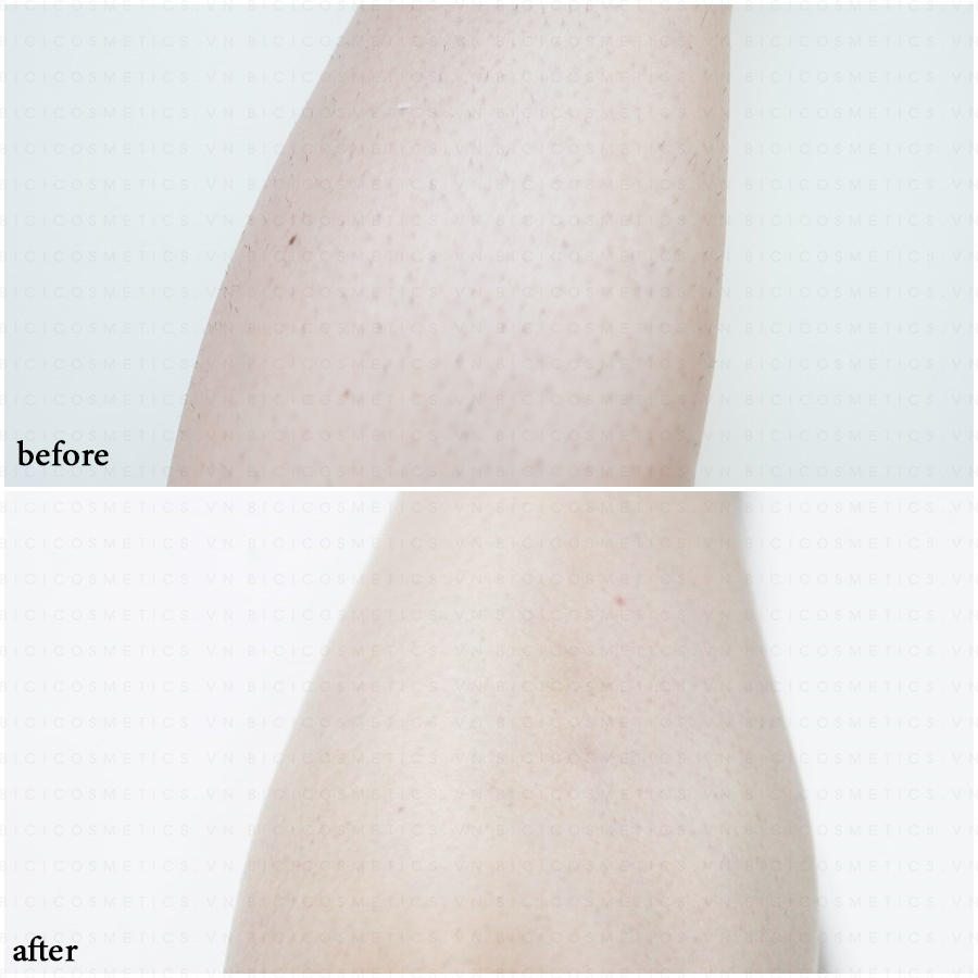 Some By Mi Perfect Clear Hair Removal Cream - Bici Cosmetic