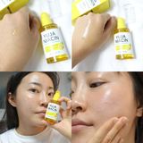  Tinh Chất Dưỡng Trắng Da Some By Mi Yuja Niacin 30 Days Blemish Care Serum 50ml 